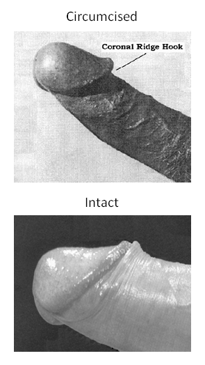 Circumcised vs Intact penis